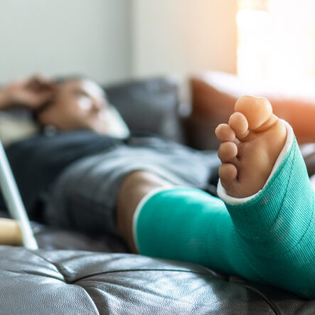 man laying on the couch with his leg in a cast